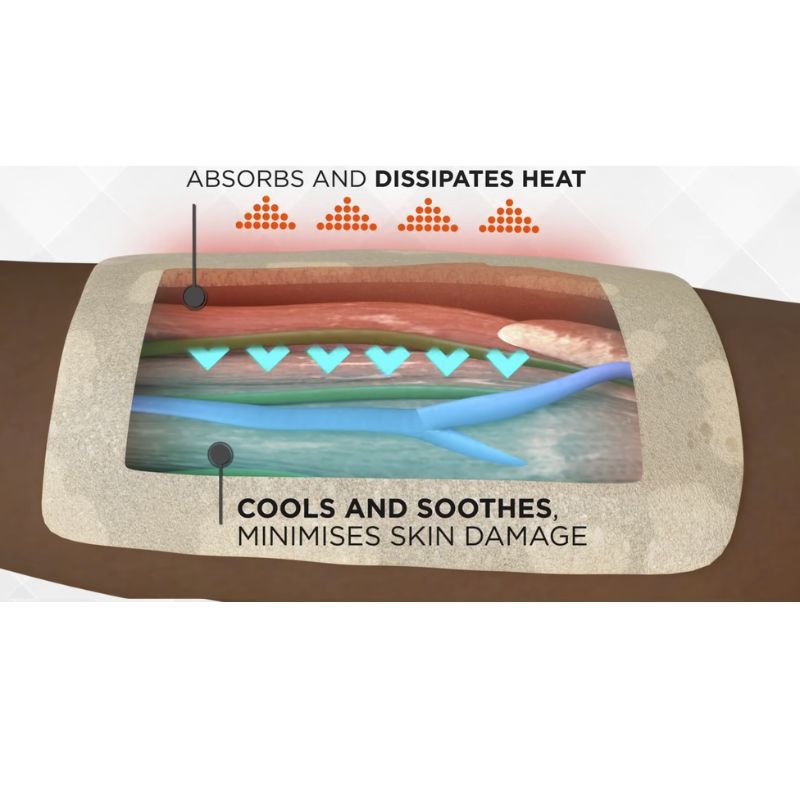 Άμεση Ψύξη & Ανακούφιση